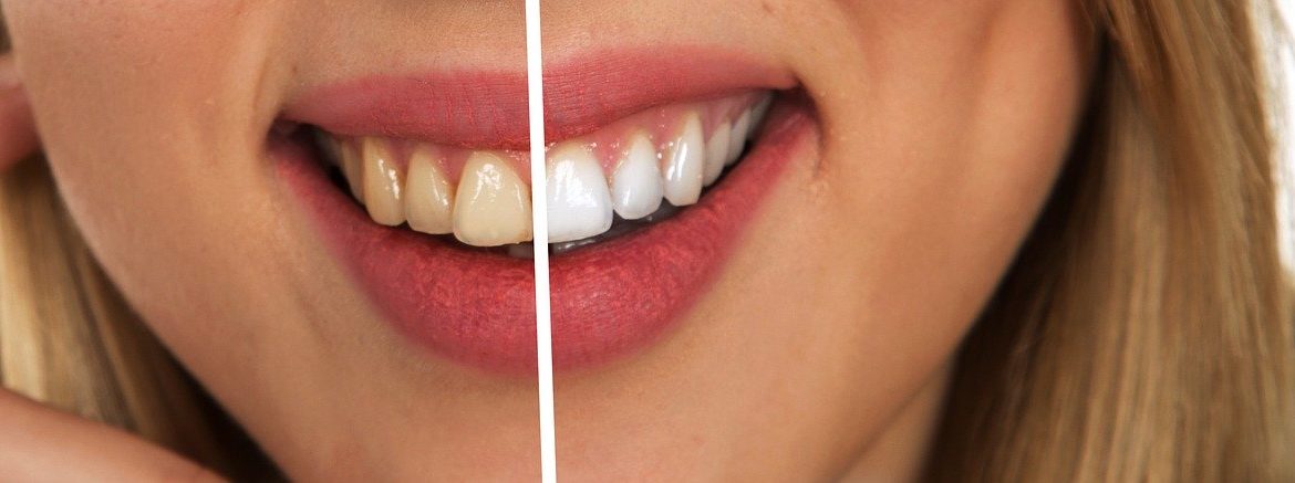 tooth, dental care, white