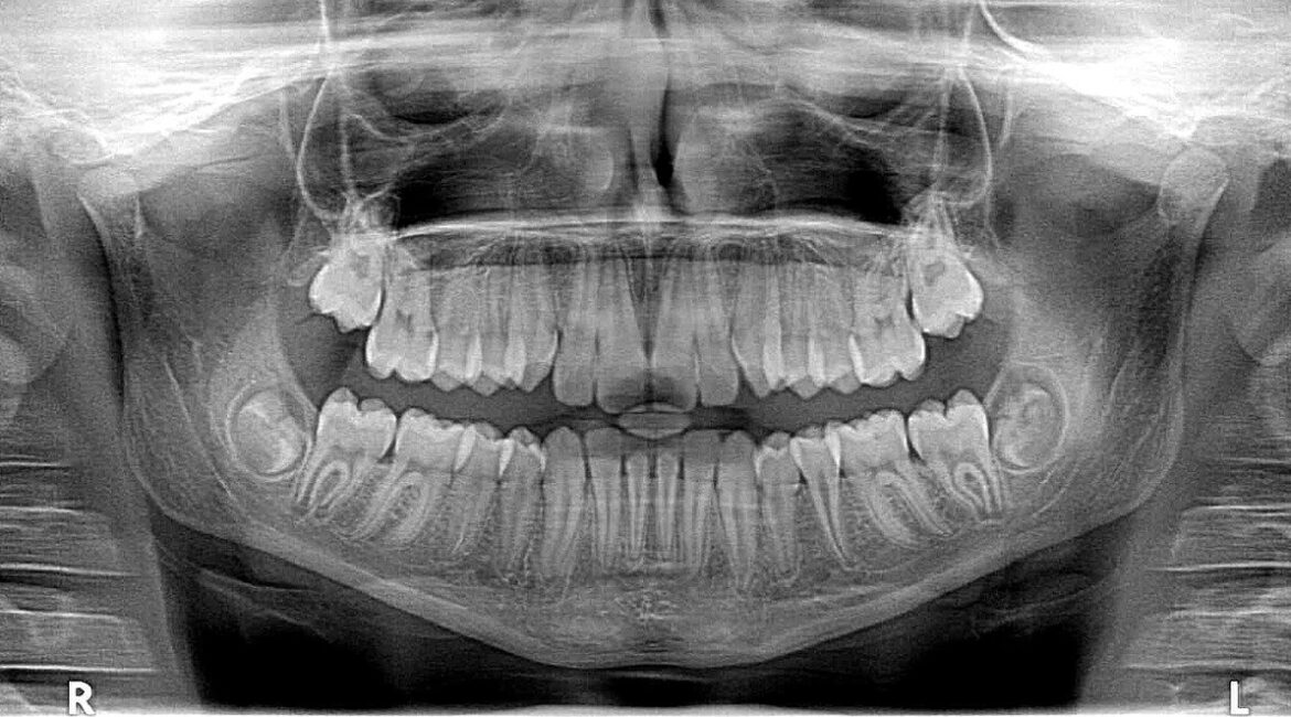 xray x-ray, x-ray, photo
